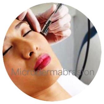 Microdermabrasion Information